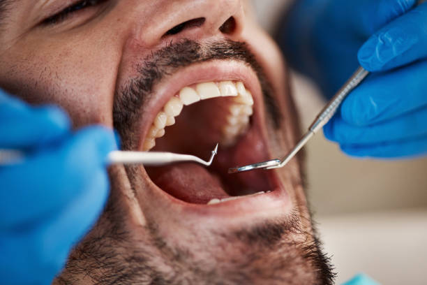 Best Emergency Dentist for Lost Fillings or Crowns in Ele, AR